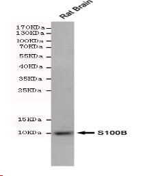 S100B Mouse mAb