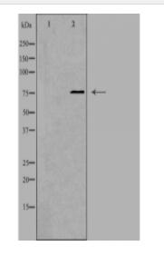 ATF6B Antibody