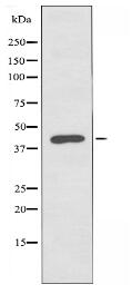 AGPAT4 Antibody