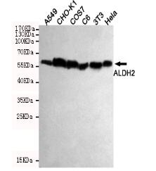 ALDH2 Mouse mAb