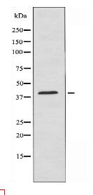 APOA5 Antibody