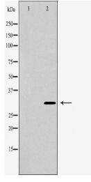 CHRNA1 Antibody