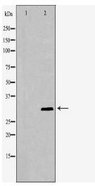 CDKN1C Antibody