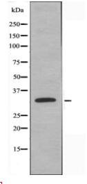 DHRS4 Antibody