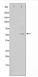 ALDH1B1 Antibody