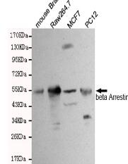 β-Arrestin 1 Mouse mAb