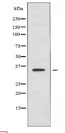 ACOT8 Antibody