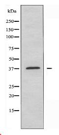 ANXA10 Antibody