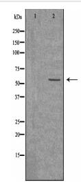 ACVL1 Antibody