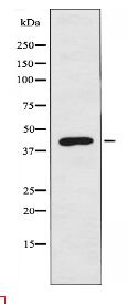 AKAP5 Antibody
