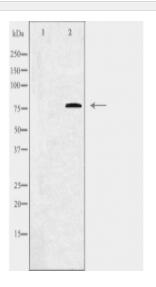 C1S Antibody