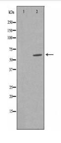 CLCC1 Antibody