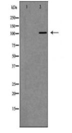 DPYD Antibody