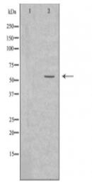 Cytochrome P450 2A6 Antibody