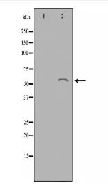 ACOT2 Antibody