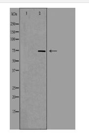 ADD3 Antibody