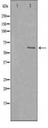 B-RAF Antibody
