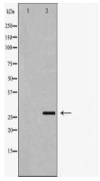 GSTT1 Antibody