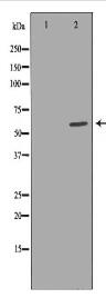 CBS Antibody