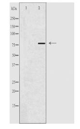 ACSL6 Antibody
