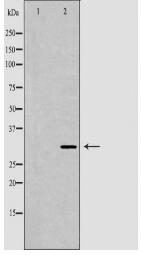 CDK20 Antibody