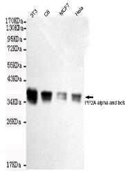 PP2A α and β Mouse mAb