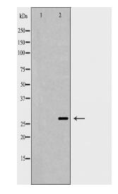AQP0 Antibody