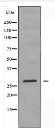 CKLF2 Antibody