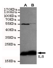 IL8 Mouse mAb