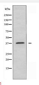 5-HT-1F Antibody