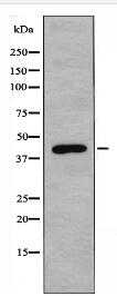 CDCA7 Antibody