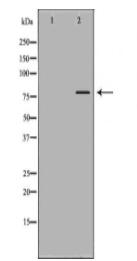 BTK Antibody