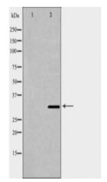 CAPZA2 Antibody