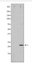 AK1 Antibody