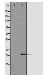 CRH Antibody