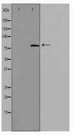CHSY2 Antibody