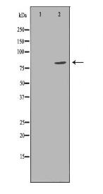 ADRBK1 Antibody