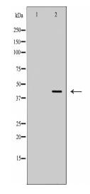 ADA Antibody