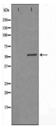 B3GALTL Antibody