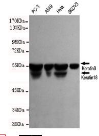 Keratin8/18 Mouse mAb