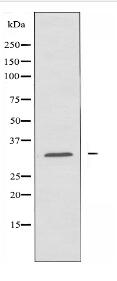 CCS Antibody