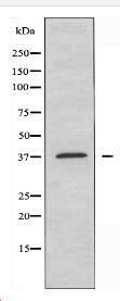 CDK5R1 Antibody