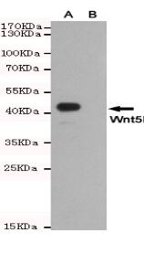 Wnt5b Mouse mAb