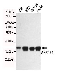 AKR1B1 Mouse mAb