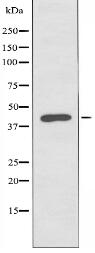 CHKB Antibody