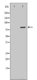 DCLRE1C Antibody