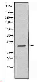 ACBD6 Antibody