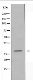 C1QB Antibody