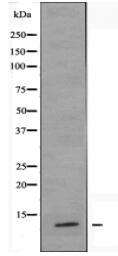 BRP44L Antibody