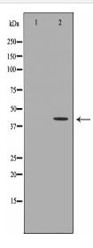 AKR7A2 Antibody